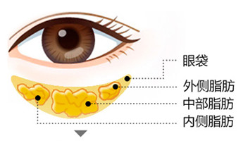 南京去眼袋比较好的医院